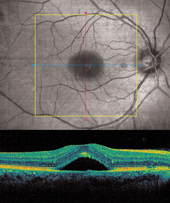 Ophthalmology Management Pentavision