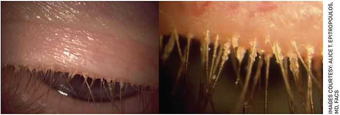 Ophthalmology Management | PentaVision